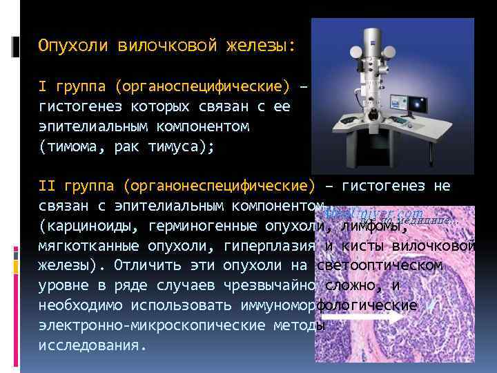 Опухоли вилочковой железы:  I группа (органоспецифические) – гистогенез которых связан с ее эпителиальным