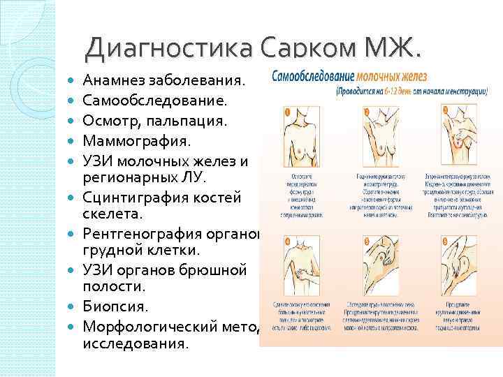 Схема самообследования молочных желез