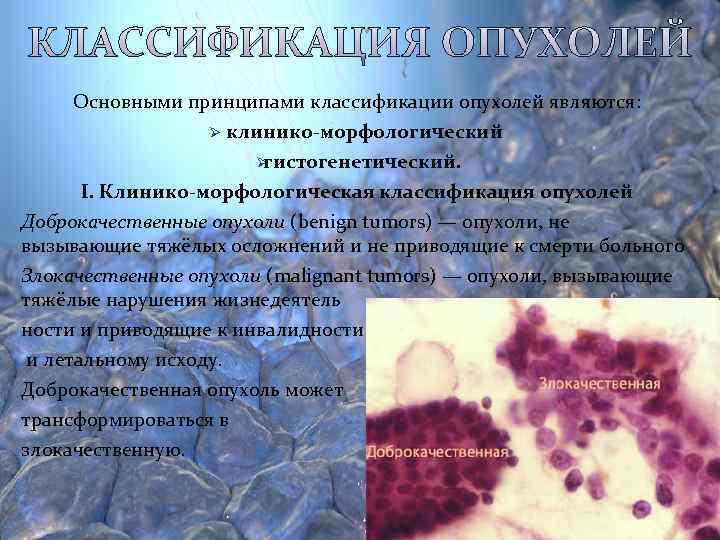 Основными принципами классификации опухолей являются:     Ø клинико-морфологический  