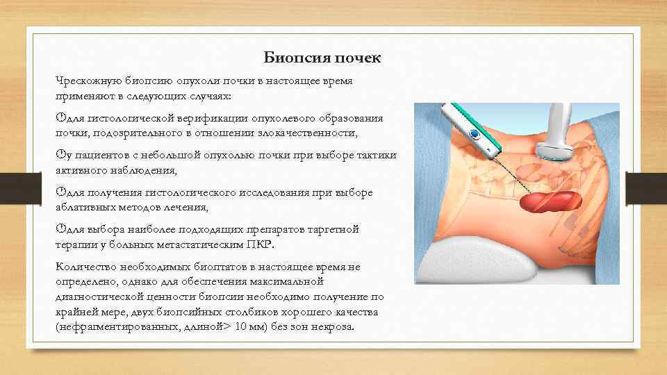       Биопсия почек Чрескожную биопсию опухоли почки в настоящее