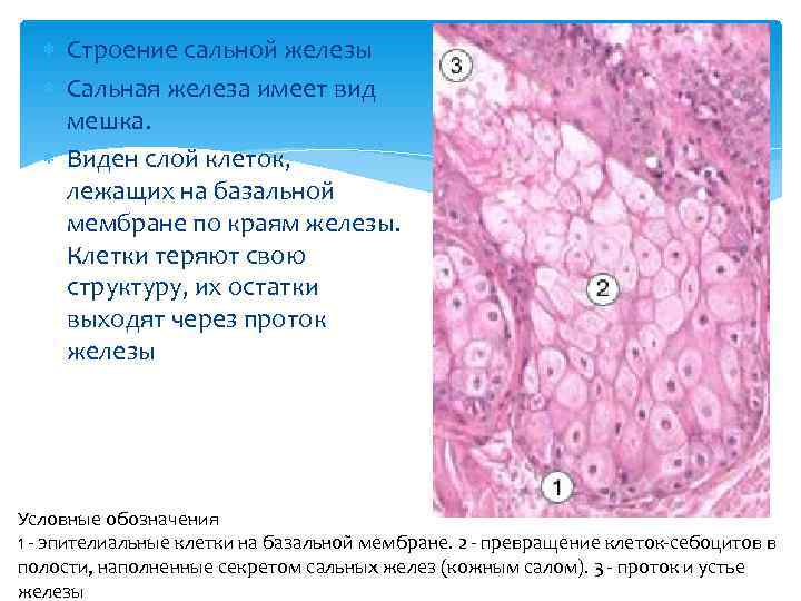 Закупорка сальной железы фото