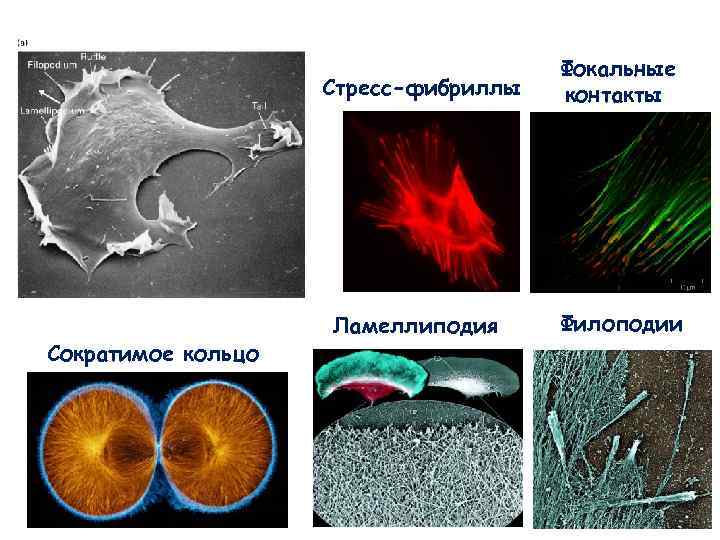 Фокальные Стресс-фибриллы Фокальные Стресс-фибриллы