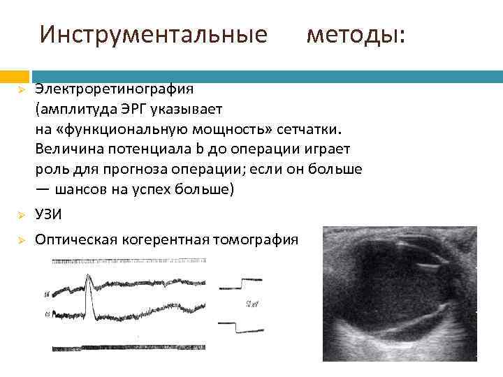 Инструментальные методы: Ø Ø Ø Электроретинография (амплитуда ЭРГ указывает на «функциональную мощность» сетчатки. Величина