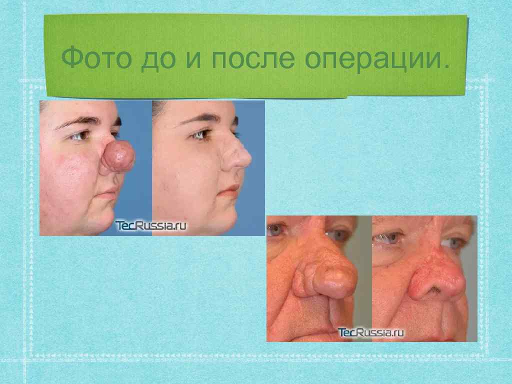 Фото до и после операции. 