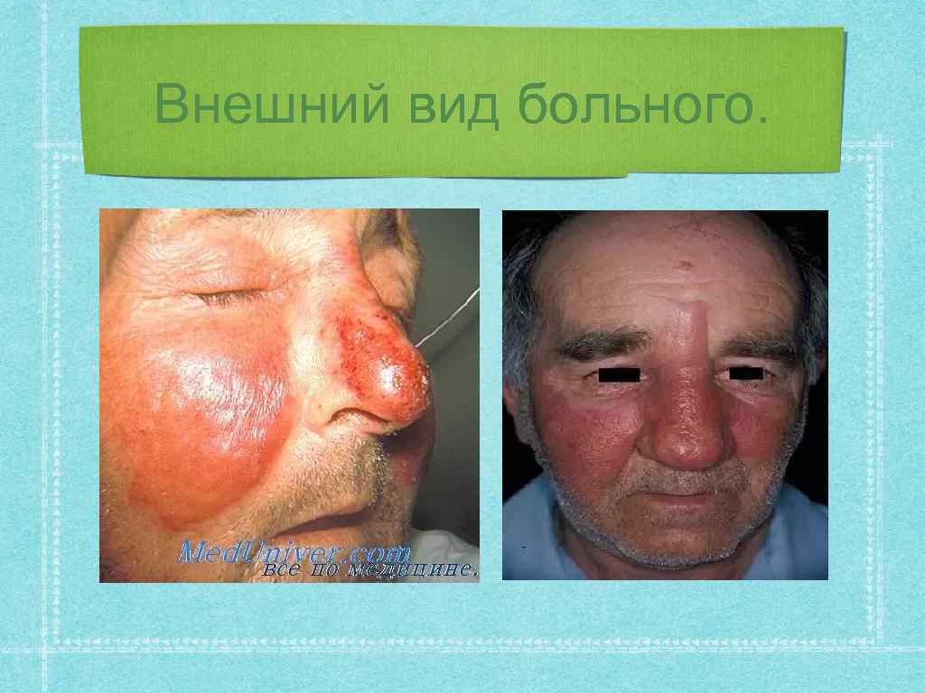 Внешний вид больного. 