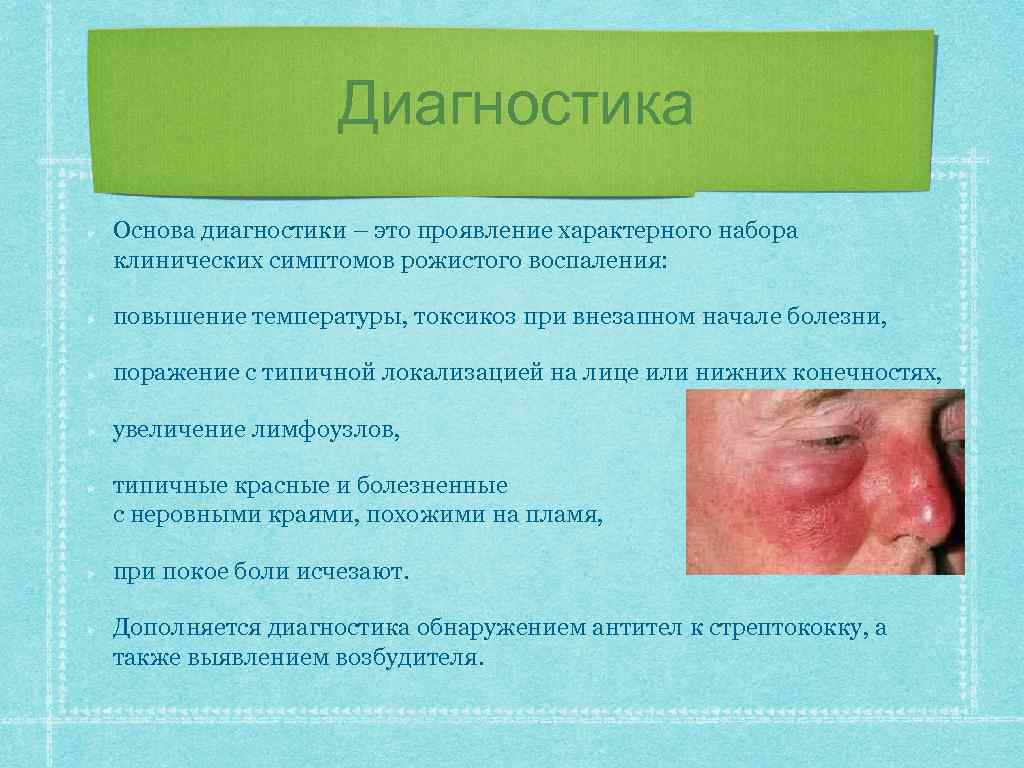 Диагностика Основа диагностики – это проявление характерного набора клинических симптомов рожистого воспаления: повышение температуры,