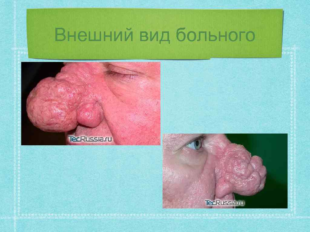 Внешний вид больного 