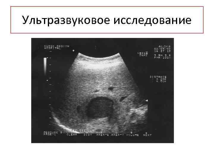 Ультразвуковое исследование 