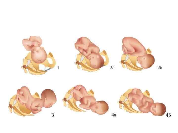Презентация биомеханизм родов при переднем и заднем виде затылочного предлежания