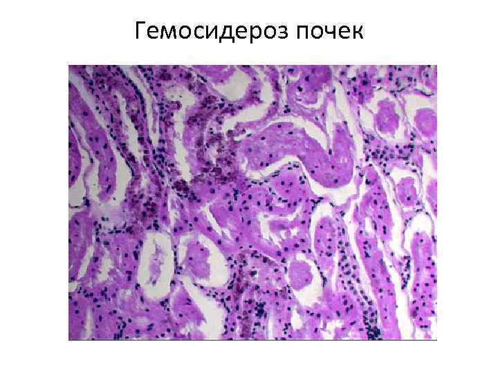 Схему образования желчных пигментов