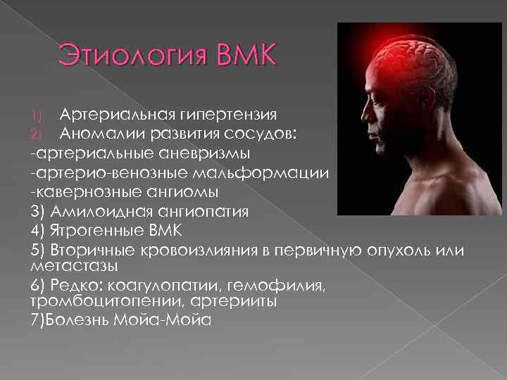 Этиология ВМК Артериальная гипертензия Аномалии развития сосудов: артериальные аневризмы артерио венозные мальформации кавернозные ангиомы