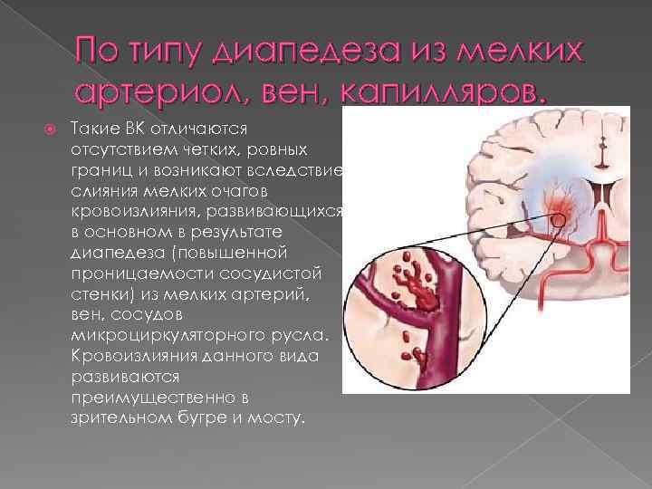 По типу диапедеза из мелких артериол, вен, капилляров. Такие ВК отличаются отсутствием четких, ровных