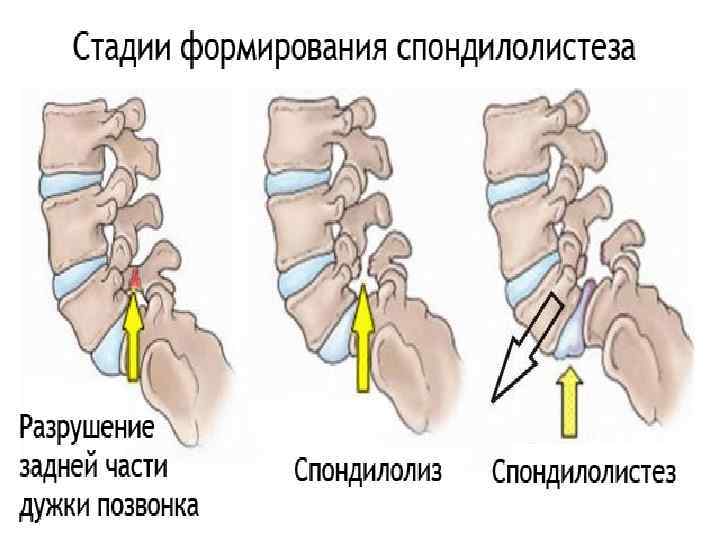 Картинка для детей скелет и мышцы