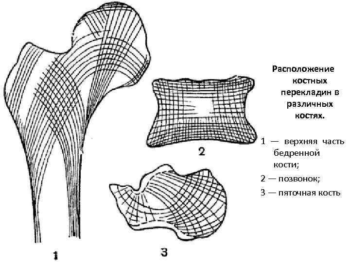 Расположение костных перекладин в различных костях. 1 — верхняя часть бедренной кости; 2 —