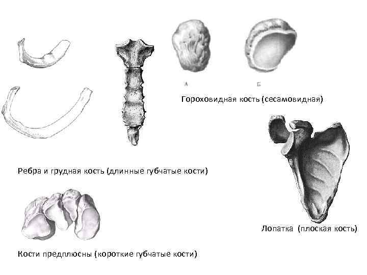 Гороховидная кость (сесамовидная) Ребра и грудная кость (длинные губчатые кости) Лопатка (плоская кость) Кости