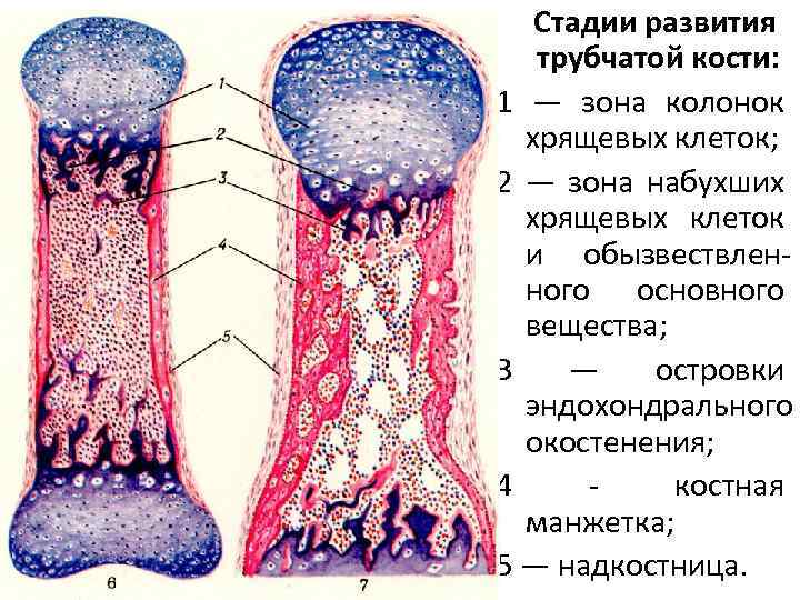  Стадии развития трубчатой кости: 1 — зона колонок хрящевых клеток; 2 — зона