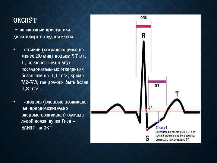ОКСПST - ангинозный приступ или дискомфорт в грудной клетке • стойкий (сохраняющийся не менее