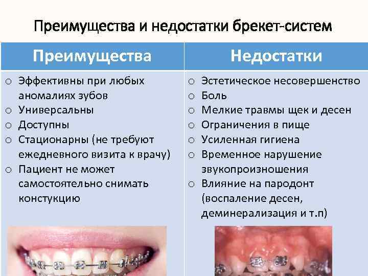 Преимущества и недостатки брекет-систем Преимущества o Эффективны при любых аномалиях зубов o Универсальны o