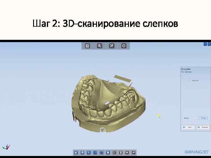 Шаг 2: 3 D-сканирование слепков 