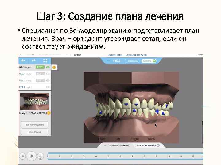 Шаг 3: Создание плана лечения • Специалист по 3 d-моделированию подготавливает план лечения, Врач