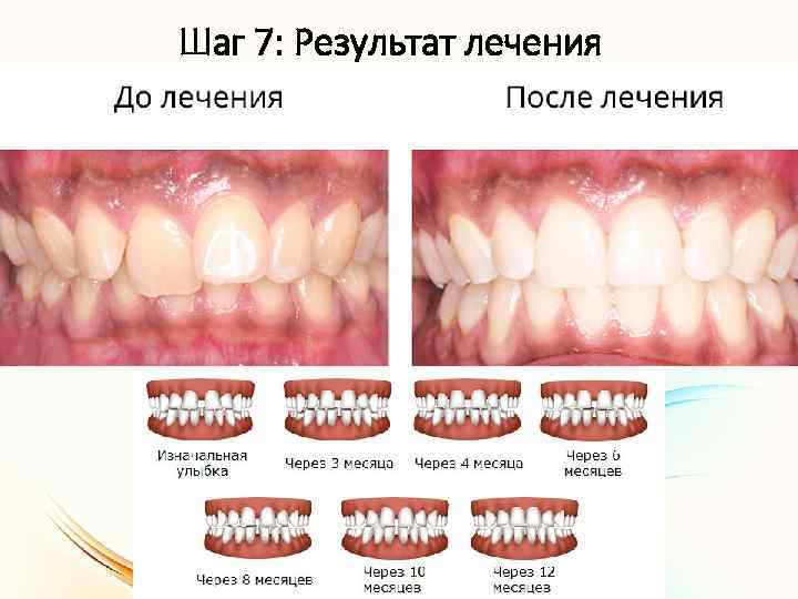 Шаг 7: Результат лечения 