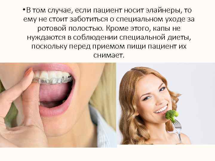  • В том случае, если пациент носит элайнеры, то ему не стоит заботиться