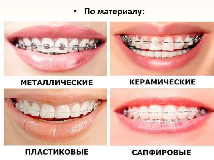  • По материалу: 