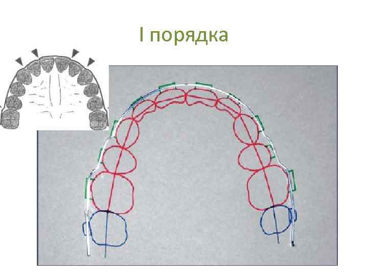 I порядка 