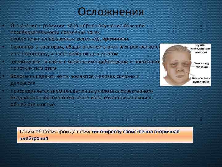 Осложнения • • • Отставание в развитии. Характерно нарушение обычной последовательности появления точек окостенения