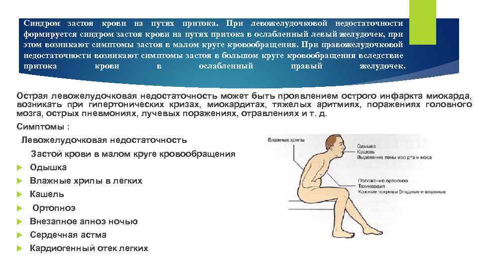 Синдром застоя крови на путях притока. При левожелудочковой недостаточности формируется синдром застоя крови на