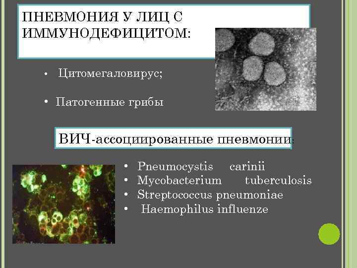  ПНЕВМОНИЯ У ЛИЦ С ИММУНОДЕФИЦИТОМ: • Цитомегаловирус; • Патогенные грибы ВИЧ-ассоциированные пневмонии: •
