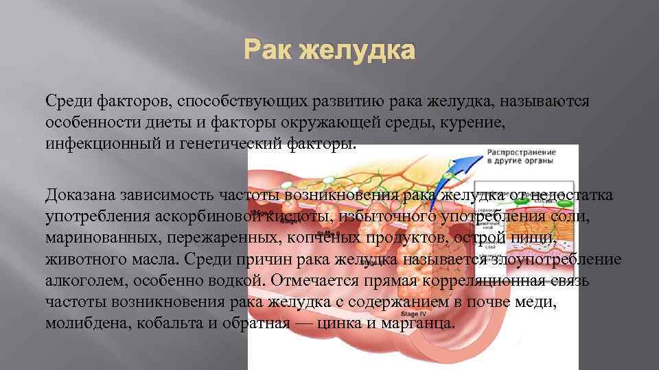 Рак желудка Среди факторов, способствующих развитию рака желудка, называются особенности диеты и факторы окружающей