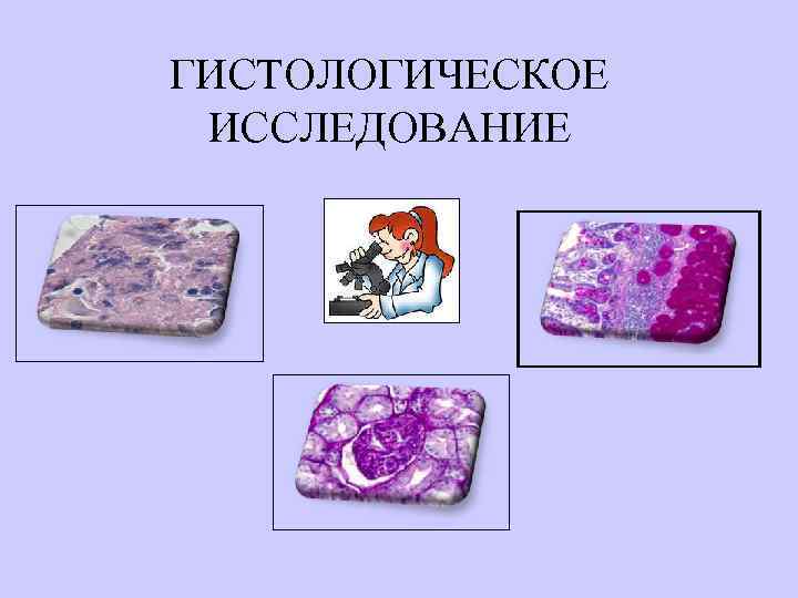 ГИСТОЛОГИЧЕСКОЕ ИССЛЕДОВАНИЕ 
