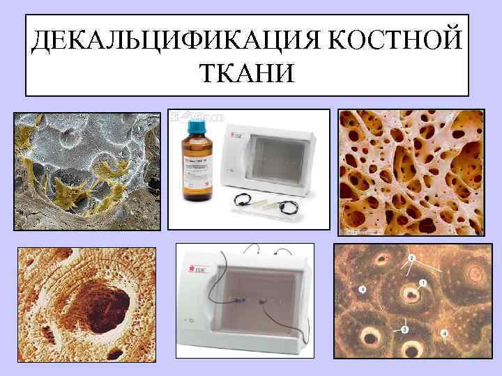 Инцизионная эксцизионная биопсия презентация