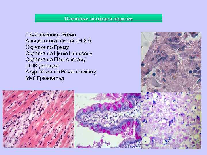 Основные методики окраски Гематоксилин-Эозин Альциановый синий р. Н 2, 5 Окраска по Граму Окраска