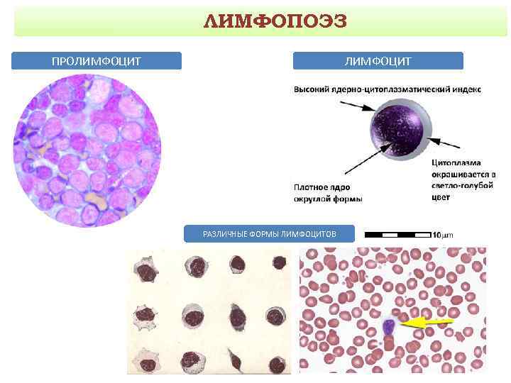 Пролимфоциты в крови фото