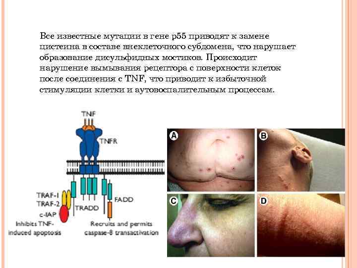 Все известные мутации в гене р55 приводят к замене цистеина в составе внеклеточного субдомена,