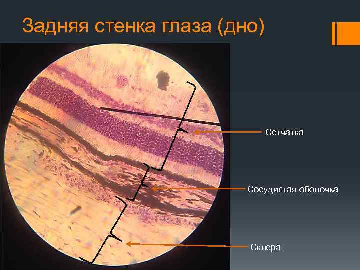 Задняя стенка глаза (дно) Сетчатка Сосудистая оболочка Склера 