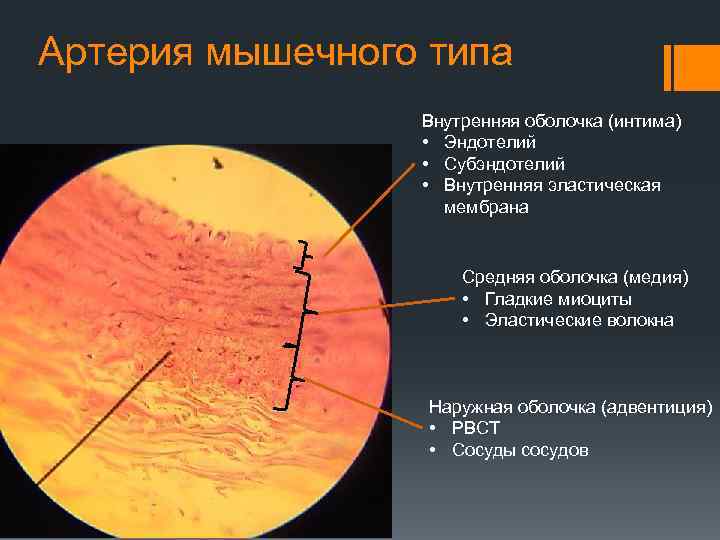 Артерия мышечного типа Внутренняя оболочка (интима) • Эндотелий • Субэндотелий • Внутренняя эластическая мембрана