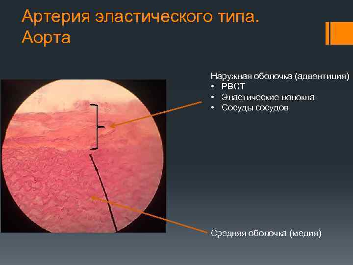 Артерия эластического типа. Аорта Наружная оболочка (адвентиция) • РВСТ • Эластические волокна • Сосуды