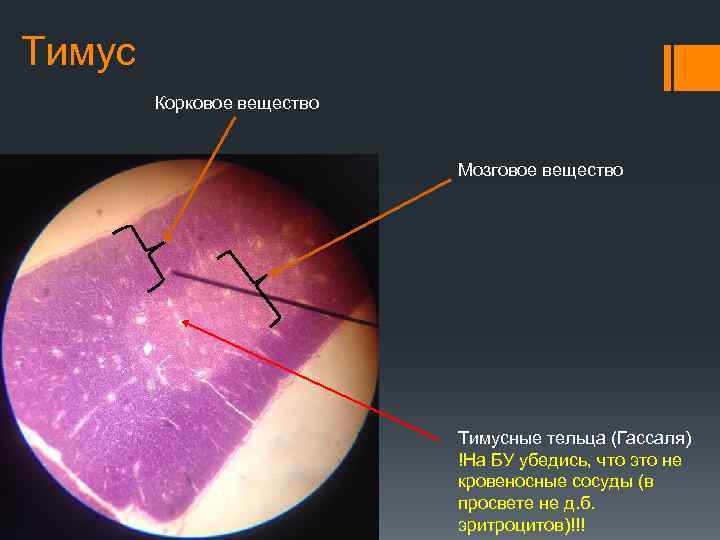 Тимус Корковое вещество Мозговое вещество Тимусные тельца (Гассаля) !На БУ убедись, что это не