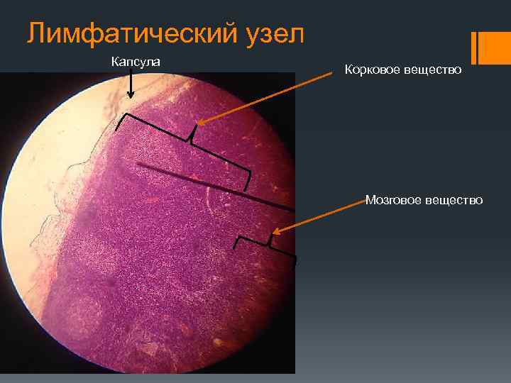 Лимфатический узел Капсула Корковое вещество Мозговое вещество 