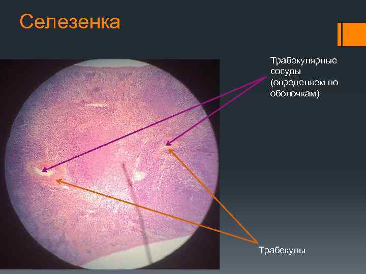 Селезенка Трабекулярные сосуды (определяем по оболочкам) Трабекулы 