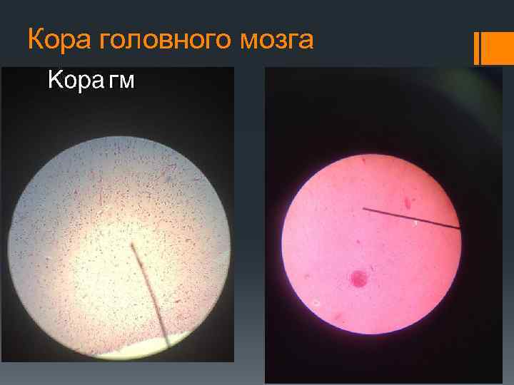 Кора головного мозга 