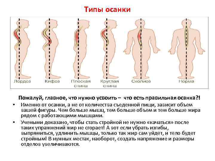 Типы осанки Пожалуй, главное, что нужно усвоить – что есть правильная осанка? ! •