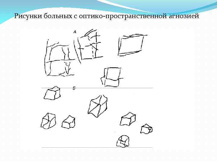 Вид агнозии характеризующийся нарушением узнавания предметов или их изображений выберите один ответ