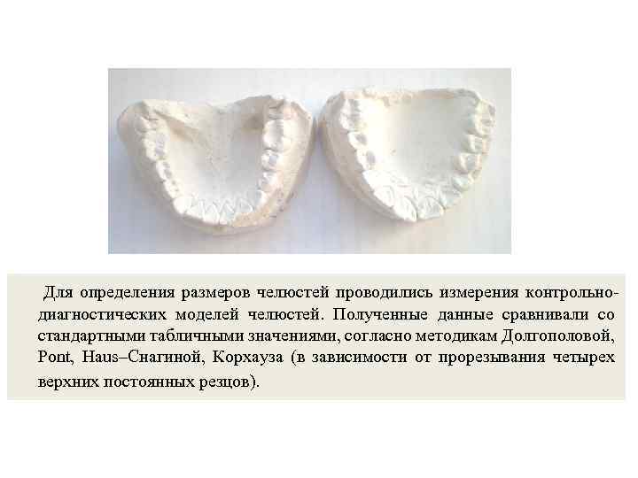 Для определения размеров челюстей проводились измерения контрольнодиагностических моделей челюстей. Полученные данные сравнивали со стандартными