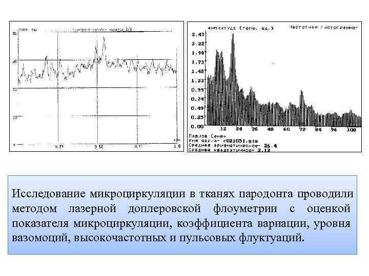 Исследование микроциркуляции в тканях пародонта проводили методом лазерной доплеровской флоуметрии с оценкой показателя микроциркуляции,