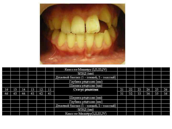 16 46 15 45 14 44 13 43 12 42 11 41 Класс по