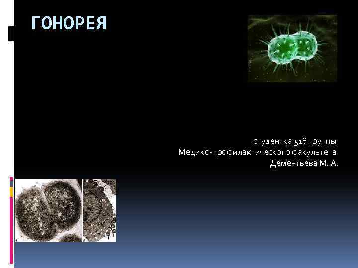 ГОНОРЕЯ студентка 518 группы Медико-профилактического факультета Дементьева М. А. 